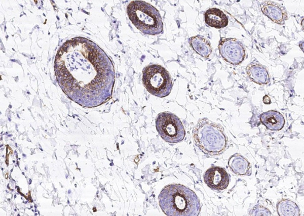 Recombinant BCAM/CD239 Monoclonal Antibody (AN300587P)