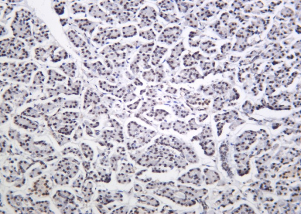 Recombinant Cdk9 Monoclonal Antibody (AN301276L)