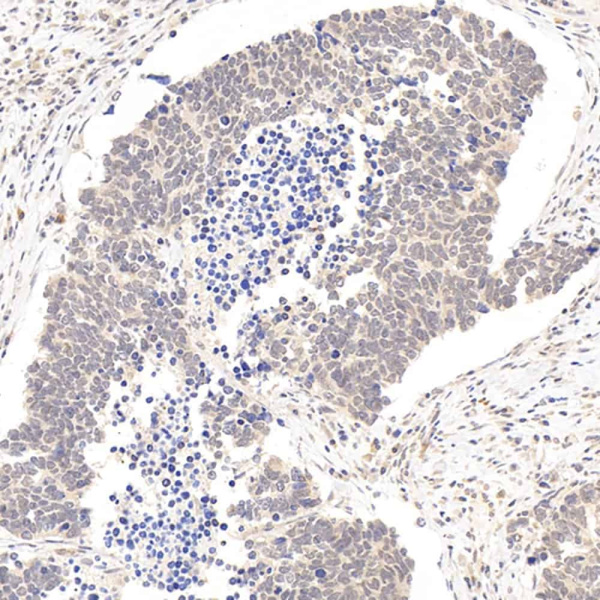 ATF6 Polyclonal Antibody (E-AB-70158)