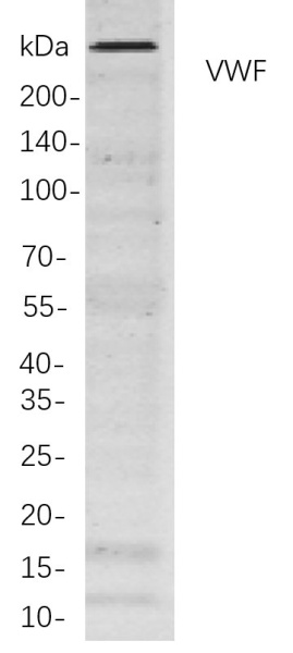 Recombinant VWF Monoclonal Antibody (AN300869L)
