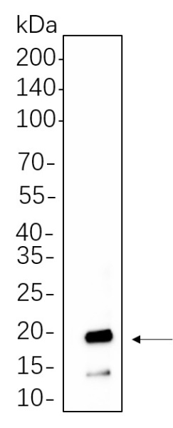 Recombinant Synuclein-α Monoclonal Antibody (AN300624L)