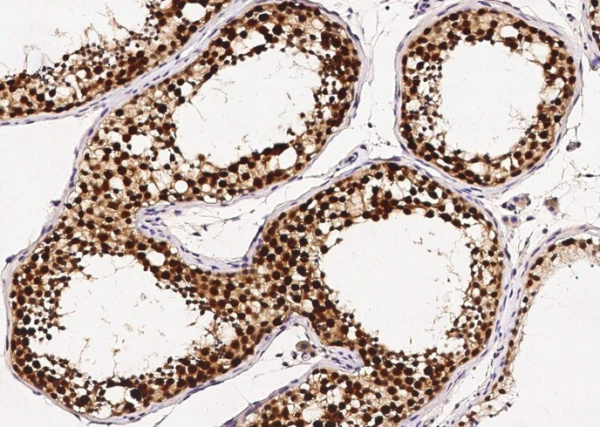 Recombinant ASF1B Monoclonal Antibody (AN300451P)