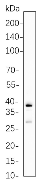 Recombinant Granzyme B Monoclonal Antibody (AN300787L)