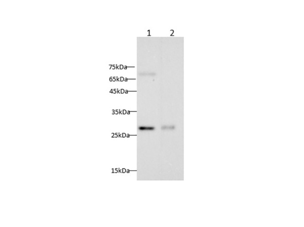 CXCL16 Polyclonal Antibody (AN006900L)