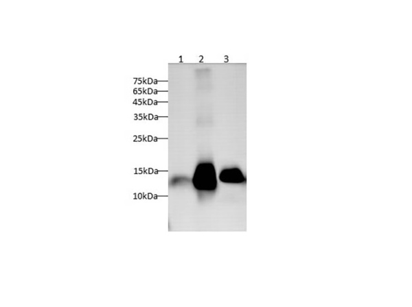 GAL7 Polyclonal antibody (AN005900L)