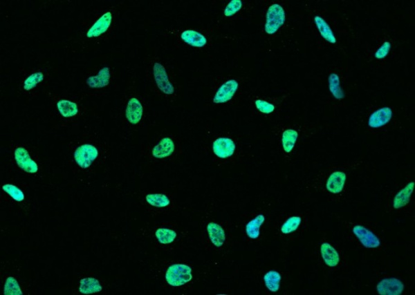 Recombinant MSH6/GTBP Monoclonal Antibody (AN300176P)