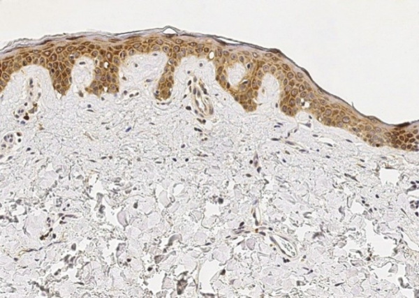 Recombinant IL-1RA/IL1RN Monoclonal Antibody (AN300077P)