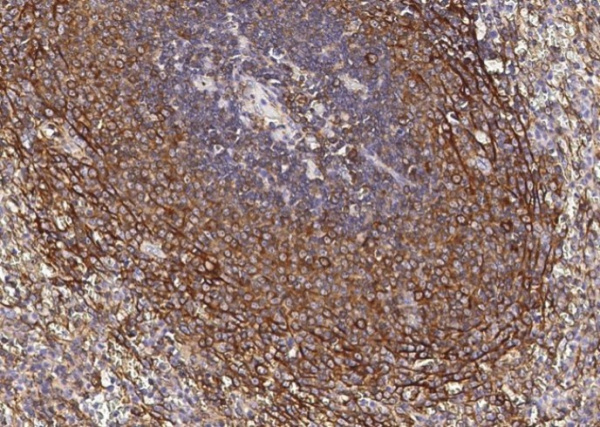 Recombinant CCR1 Monoclonal Antibody (AN300172P)