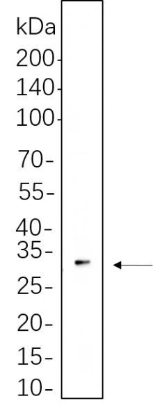 Recombinant TWIST1 Monoclonal Antibody (AN301348L)