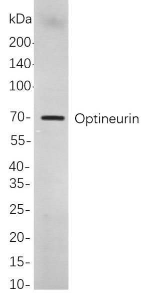 Recombinant Optineurin Monoclonal Antibody (AN301073L)