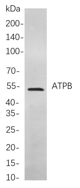 Recombinant ATPB Monoclonal Antibody (AN300965L)