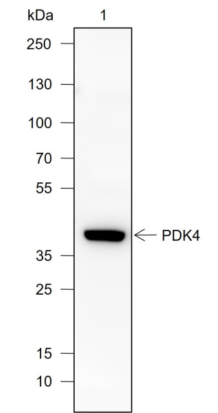 Recombinant PDK4 Monoclonal Antibody (AN302015L)