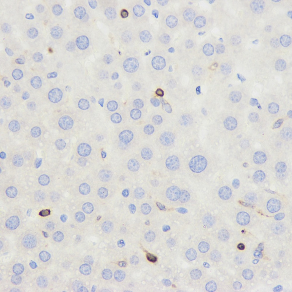 CD45 Polyclonal Antibody (E-AB-70024)