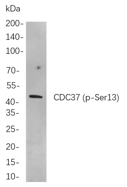 Recombinant Phospho-CDC37 (Ser13) Monoclonal Antibody (AN301045L)