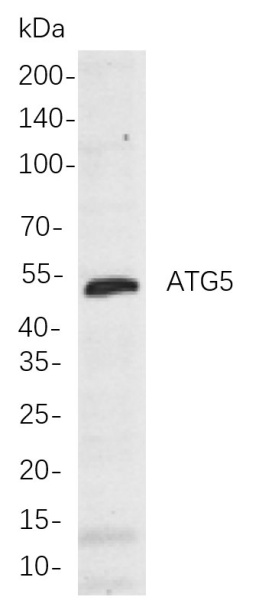 Recombinant ATG5 Monoclonal Antibody (AN300864L)
