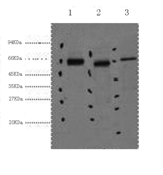 CK-7 Monoclonal Antibody (E-AB-22017)