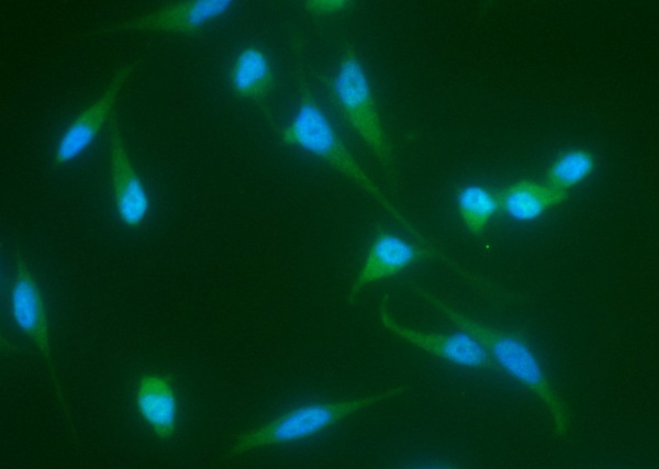 Recombinant JNK2/MAPK9 Monoclonal Antibody (AN300348P)