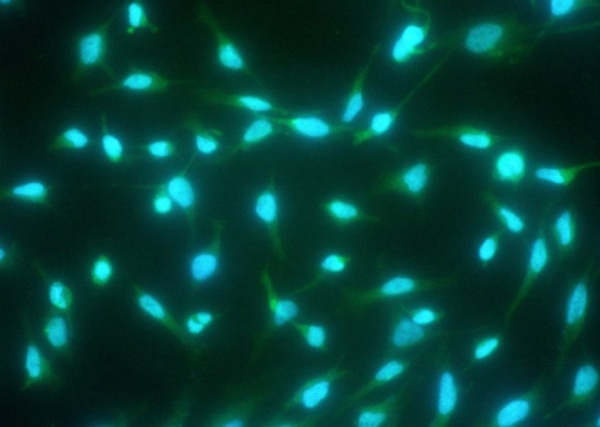Recombinant Caspase-14/CASP14 Monoclonal Antibody (AN300033P)