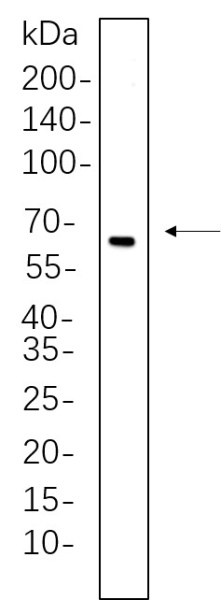 Recombinant Estrogen Receptor α Monoclonal Antibody (AN300734L)