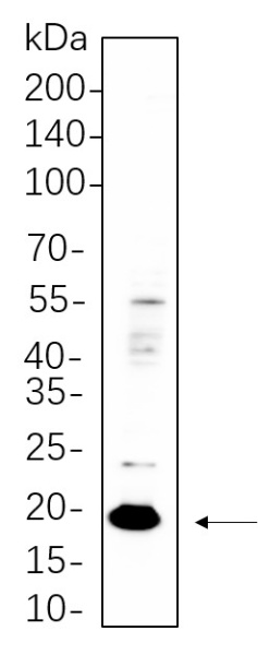 Recombinant Claudin 3 Monoclonal Antibody (AN300602L)