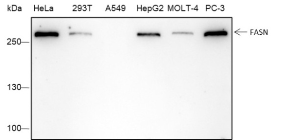 Recombinant FASN Monoclonal Antibody (AN301520L)