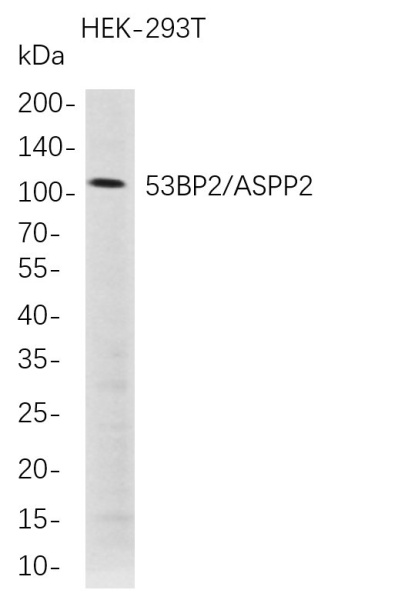 Recombinant 53BP2/ASPP2 Monoclonal Antibody (AN300764L)