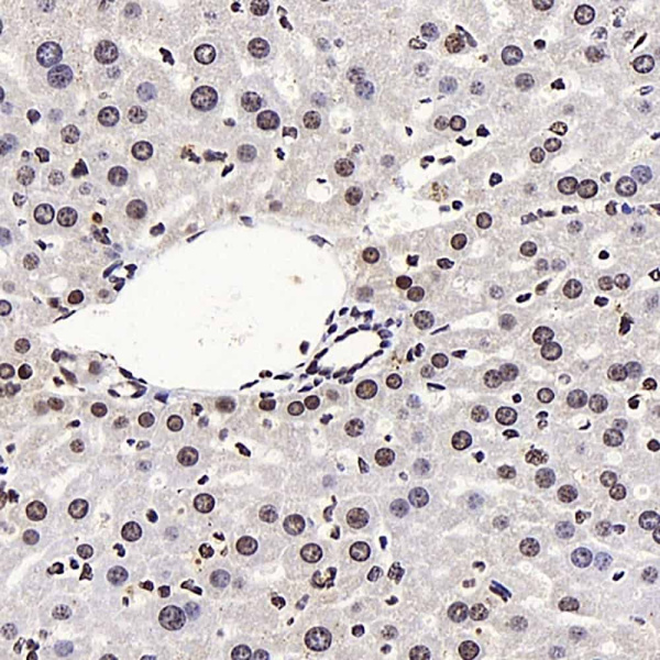 LXR alpha Polyclonal Antibody (E-AB-70218)