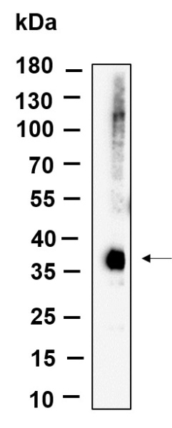 Recombinant Phospho-eIF2α (Ser51) Monoclonal Antibody (AN301168L)