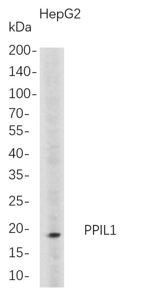 Recombinant PPIL1 Monoclonal Antibody (AN300762L)