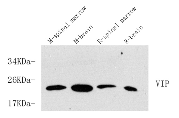 VIP Polyclonal Antibody (E-AB-70137)