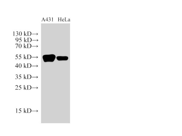 CK14 Polyclonal Antibody (E-AB-40480)