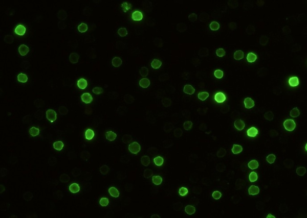 Recombinant CD5/Cluster of Differentiation 5 Monoclonal Antibody (AN300514P)