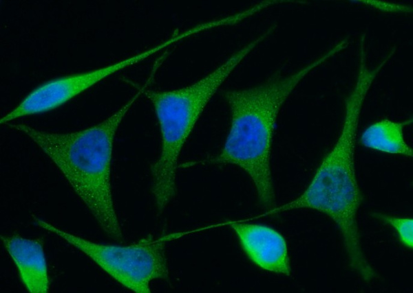 Recombinant Renin/REN/Angiotensinogenase Monoclonal Antibody (AN300357P)