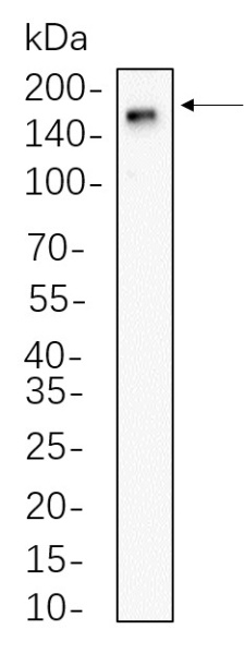Recombinant CD11b Monoclonal Antibody (AN300797L)