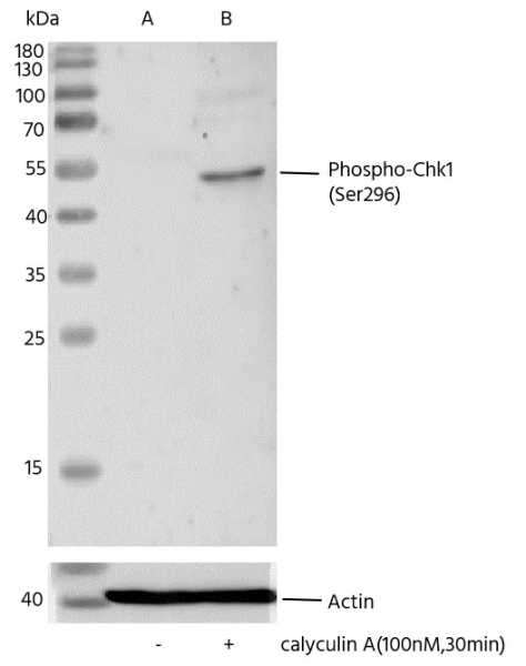 Recombinant Phospho-Chk1 (Ser296) Monoclonal Antibody (AN300388L)