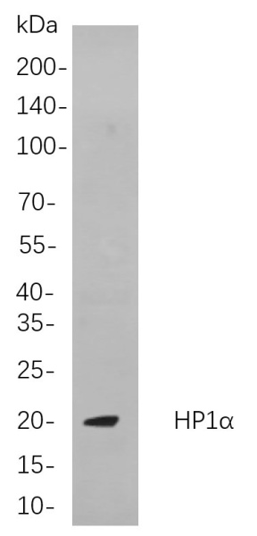 Recombinant HP1α Monoclonal Antibody (AN300946L)
