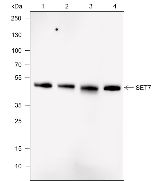 Recombinant SET7 Monoclonal Antibody (AN302013L)