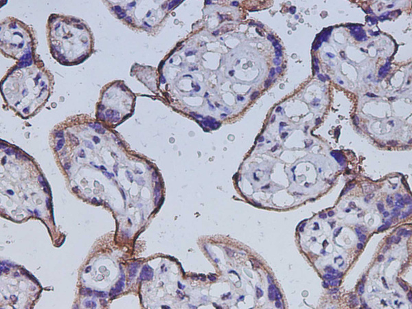 CD105 Polyclonal Antibody (D-AB-10448L)