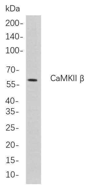 Recombinant CaMKII β Monoclonal Antibody (AN300888L)