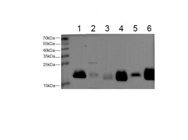 Ferritin Heavy Polyclonal Antibody (E-AB-40633)