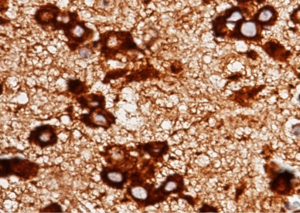 Recombinant LRPAP1 Monoclonal Antibody (AN300503P)