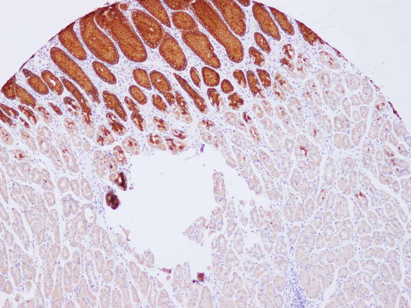 MUC5AC Polyclonal Antibody (E-AB-40276)