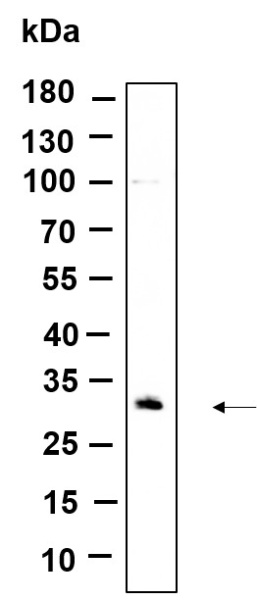 Recombinant CDIN1 Monoclonal Antibody (AN301205L)