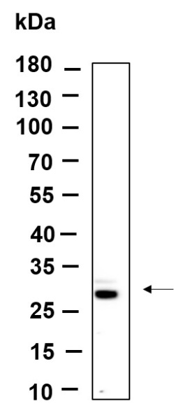 Recombinant FRAT1 Monoclonal Antibody (AN301229L)