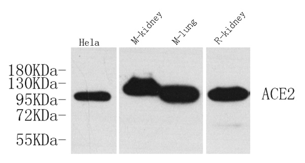 ACE2 Polyclonal Antibody (E-AB-70126)