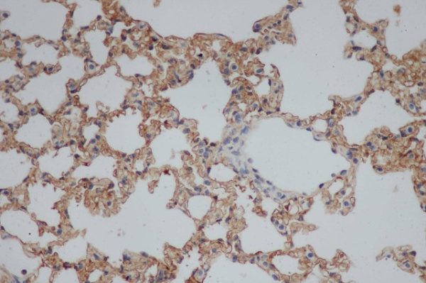 CD244 Polyclonal Antibody (E-AB-40060)