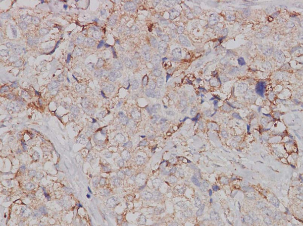JAK1 Polyclonal Antibody (AN006070L)
