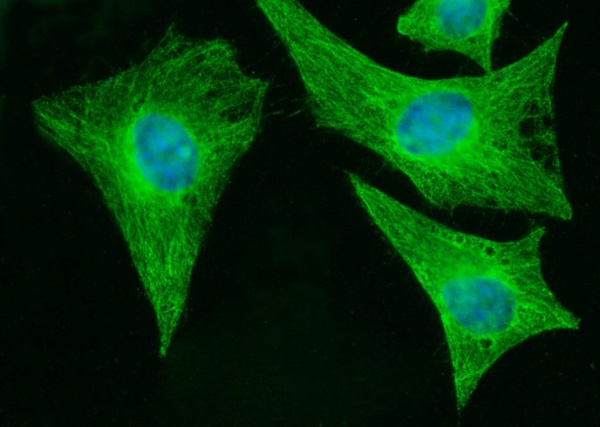 MOB1B/MOBKL1A Monoclonal Antibody (AN200234P)