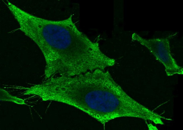 Recombinant GSTM2 Monoclonal Antibody (AN300247P)