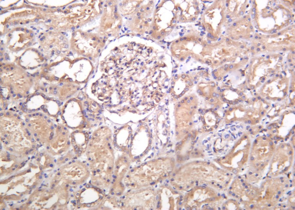 Recombinant MYH9 Monoclonal Antibody (AN301290L)